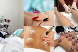 Recovery Treatment – โปรแกรมรักษาอาการปวดตึงกล้ามเนื้อโดยแพทย์เฉพาะทาง (ฝังเข็ม / ครอบแก้ว / กัวซา)