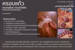 ครอบแก้ว โดยศาสตร์การแพทย์แผนไทย - แฮปปี้แลนด์ บางกะปิ และใกล้เคียง