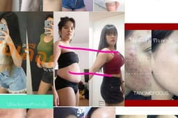 จัดหาภาพเปรียบเทียบ ก่อนใช้-หลังใช้, Before-After (ไม่ขายภาพซ้ำ)